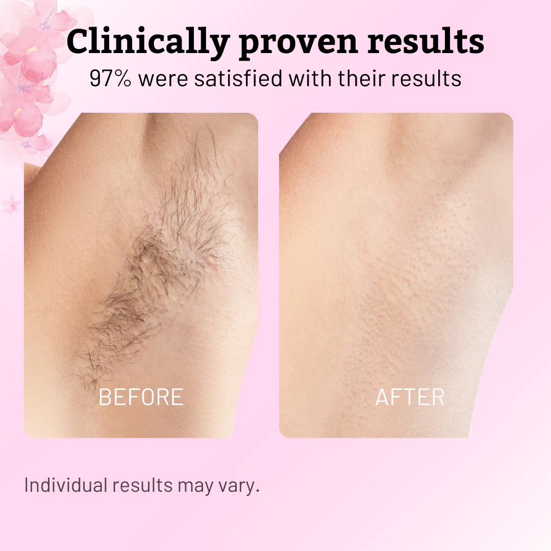 Caramela Beauty Cyperus Rotundus Oil for Natural Permanent Hair Reduction